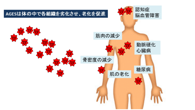 老化物質AGEsが体のあちこちで重篤な疾病をもたらす原因となることを表した図。